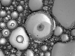 Blasen (Seife, Wasser, Öl) in ca. 2:1 aufgenommen